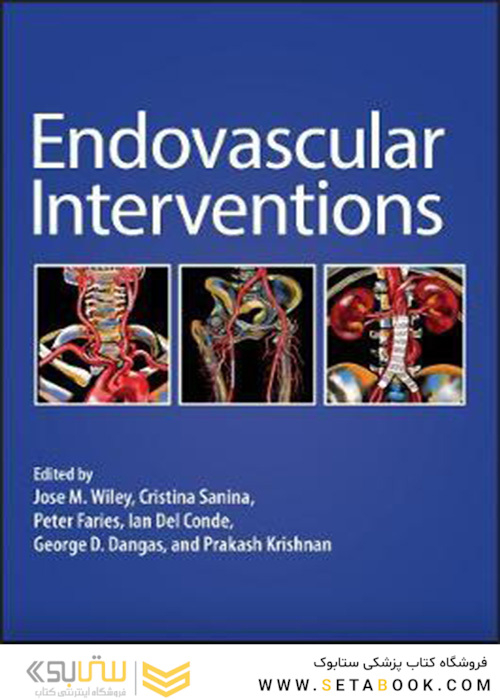 Endovascular Interventions
