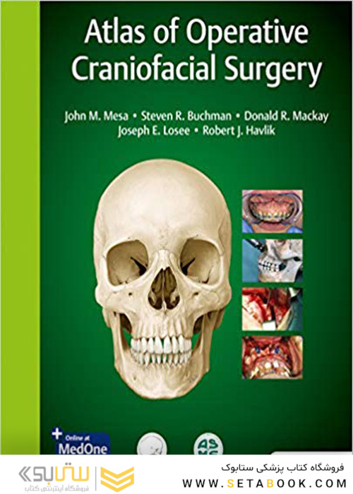 Atlas of Operative Craniofacial Surgery