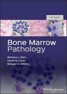 عکس پاتولوژی مغز استخوان  Bone Marrow Pathology 2019