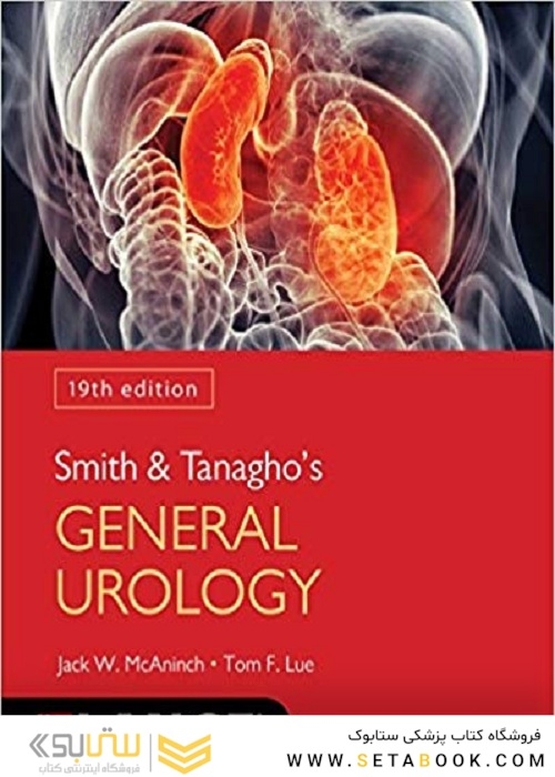 Smith and Tanagho
