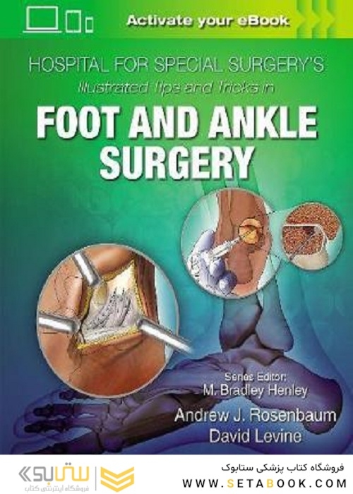 Hospital for Special Surgery