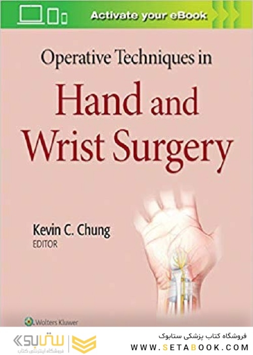 Operative Techniques in Hand and Wrist Surgery