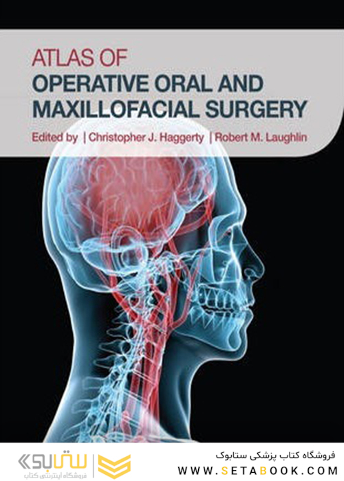 Atlas of Operative Oral and Maxillofacial Surgery