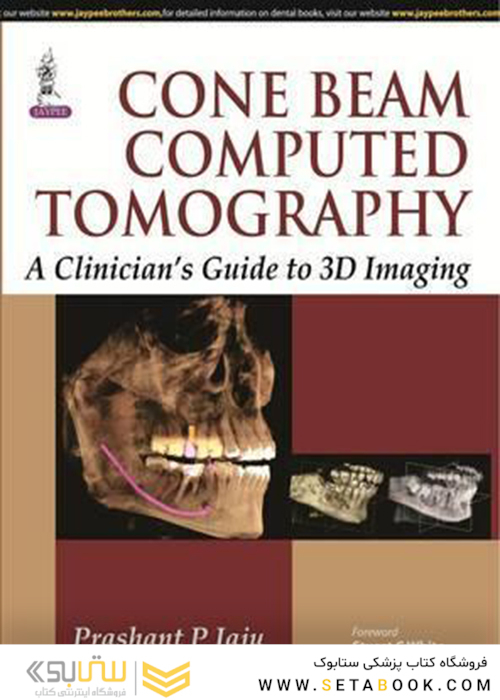 Cone Beam Computed Tomography