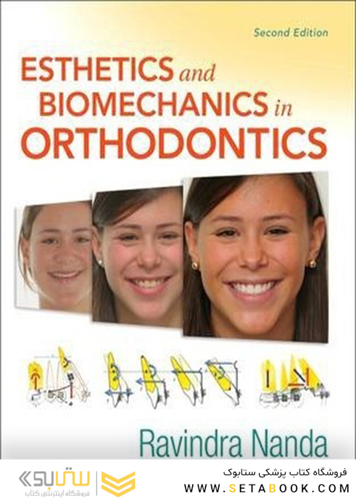 Esthetics and Biomechanics in Orthodontics