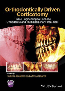 عکس Orthodontically Driven Corticotomy