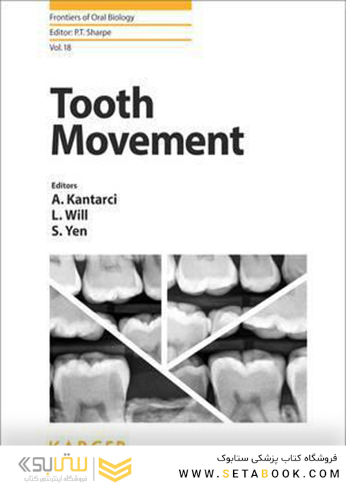 Tooth Movement