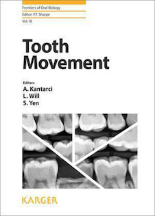 عکس Tooth Movement