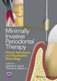 عکس Minimally Invasive Periodontal Therapy : Clinical Techniques and Visualization Technology