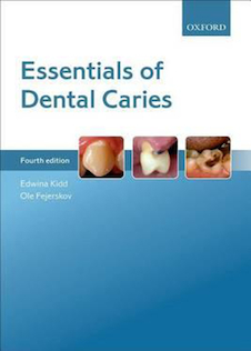 عکس Essentials of Dental Caries