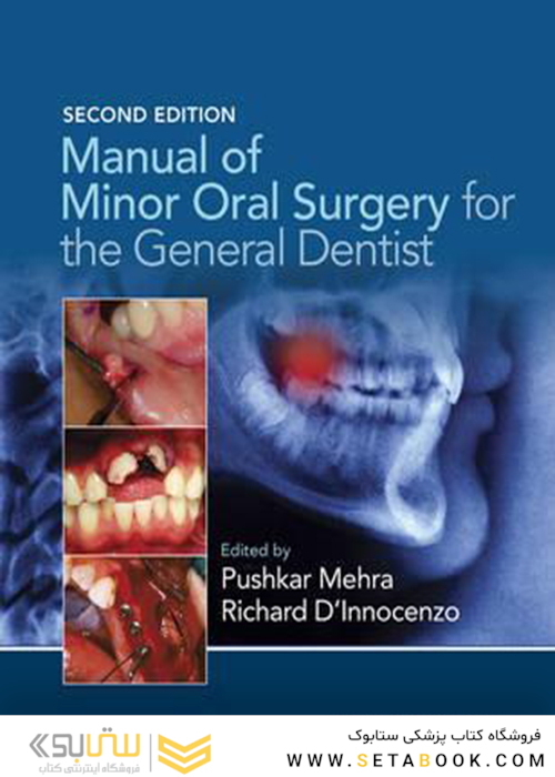 Manual of Minor Oral Surgery for the General Dentist
