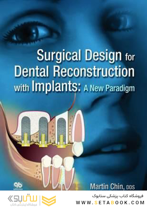 Surgical Design for Dental Reconstruction with Implants : A New Paradigm