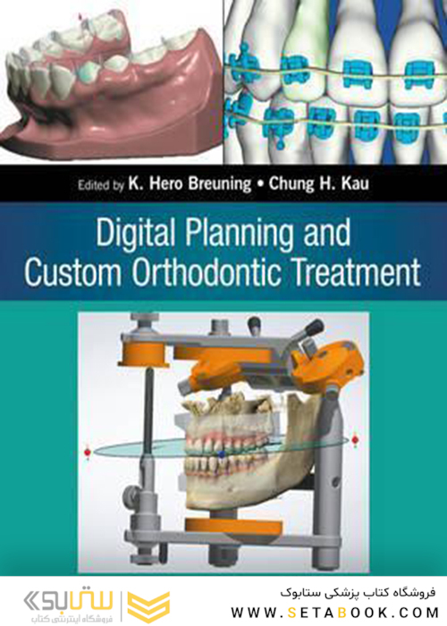 Digital Planning and Custom Orthodontic Treatment