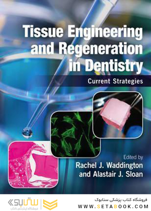 Tissue Engineering and Regeneration in Dentistry : Current Strategies