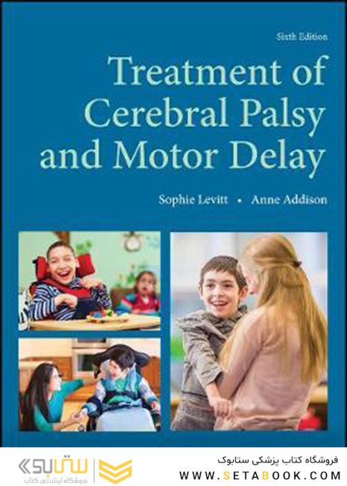 Treatment of Cerebral Palsy and Motor Delay