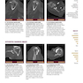  تصویربرداری عضلانی و اسکلتی اسکلت Musculoskeletal Imaging Cases 