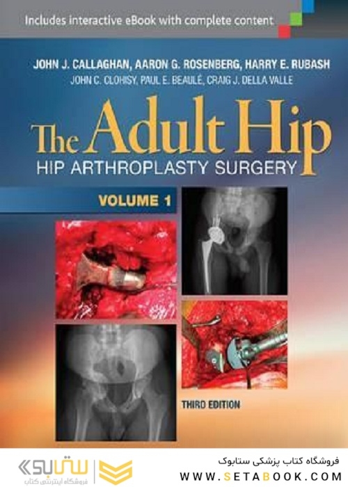 The Adult Hip (Two Volume Set) : Hip Arthroplasty Surgery 2016 هیپ بزرگسالان (مجموعه دو جلدی)