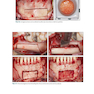 Bone Augmentation in Implant Dentistry: A Step-by-Step Guide to Predictable Alveolar Ridge and Sinus Grafting 1st Edition 2019  افزایش استخوان در دندانپزشکی ایمپلنت