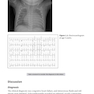 Challenging Cases in Neonatology: Cases from NeoReviews Index of Suspicion in the Nursery and Visual Diagnosis  First Edition 2019