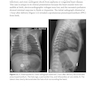 Challenging Cases in Neonatology: Cases from NeoReviews Index of Suspicion in the Nursery and Visual Diagnosis  First Edition 2019