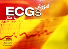 عکس آموزش ECGs با مثال
