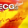 آموزش ECGs با مثال