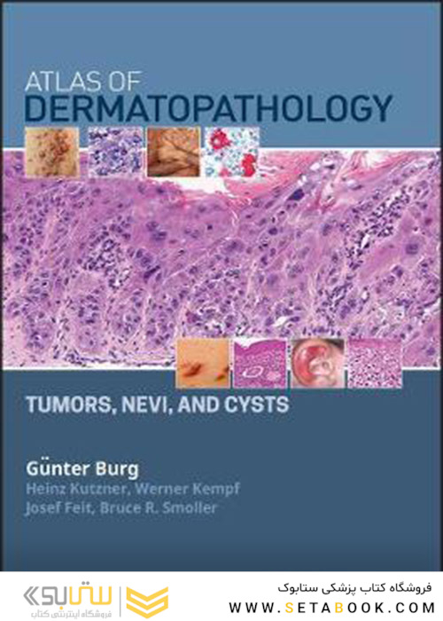   Atlas of Dermatopathology: Tumors, Nevi, and Cysts 1st Edition, Kindle Edition 2019 اطلس پوست : تومورها ، نووی و کیست 