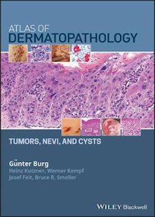 عکس   Atlas of Dermatopathology: Tumors, Nevi, and Cysts 1st Edition, Kindle Edition 2019 اطلس پوست : تومورها ، نووی و کیست 