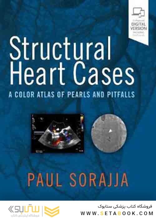 کتاب موارد قلبی ساختاری: اطلس رنگی مرواریدها و گودالها Structural Heart Cases: A Color Atlas of Pearls and Pitfalls 1st Edition 2019