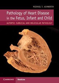 عکس 2019 Pathology of Heart Disease in the Fetus, Infant and Child: Autopsy, Surgical and Molecular Pathology 1st Edition  آسیب شناسی بیماری قلبی در جنین ، نوزاد و کودک