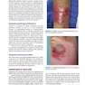 2019 Text and Atlas of Wound Diagnosis and Treatment, Second Edition 2nd Edition