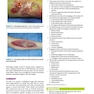 2019 Text and Atlas of Wound Diagnosis and Treatment, Second Edition 2nd Edition