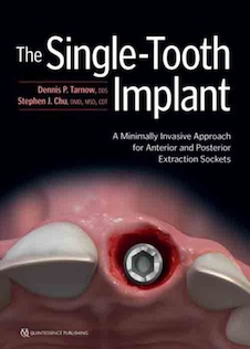 عکس The Single-Tooth Implant: A Minimally Invasive Approach for Anterior and Posterior Extraction Sockets 1st Edition 2020