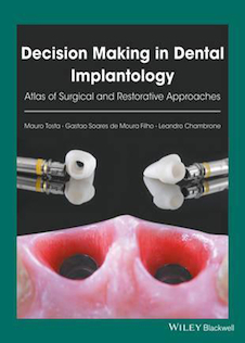 عکس Decision Making in Dental Implantology: Atlas of Surgical and Restorative Approaches 1st Edition, Kindle Edition 2018 تصمیم گیری در ایمپلنتولوژی دندانپزشکی: اطلس رویکردهای جراحی و ترمیمی