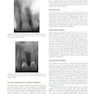 Endodontics: Principles and Practice 6th Edition 2021