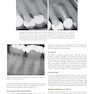 Endodontics: Principles and Practice 6th Edition 2021