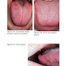 Pocketbook of Oral Disease 2012