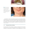 Bone Management in Dental Implantology 1st ed. 2019 Edition