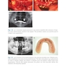 Bone Management in Dental Implantology 1st ed. 2019 Edition