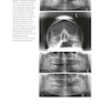 Bone Management in Dental Implantology 1st ed. 2019 Edition