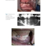Bone Management in Dental Implantology 1st ed. 2019 Edition