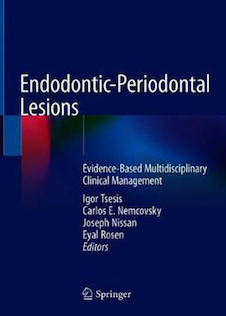 عکس Endodontic-Periodontal Lesions: Evidence-Based Multidisciplinary Clinical Management 1st ed. 2019 Edition, Kindle Edition ضایعات اندودنتیک-پریودنتال
