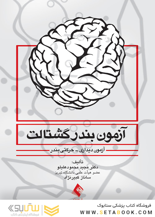 آزمون بندر گشتالت (آزمون دیداری-حرکتی بندر)