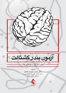 عکس آزمون بندر گشتالت (آزمون دیداری-حرکتی بندر)