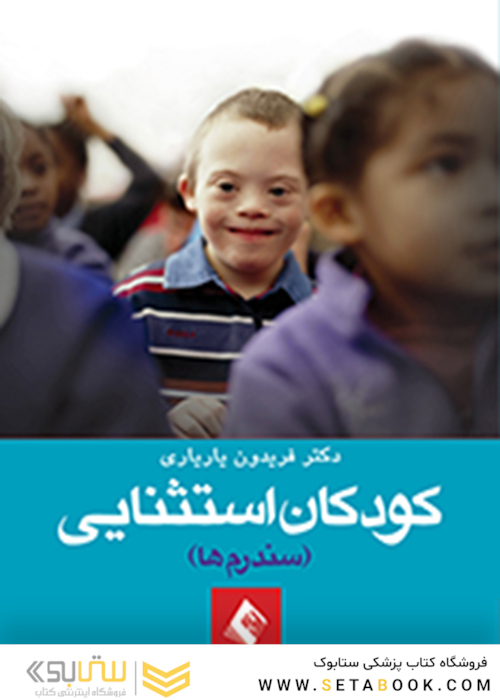 کودکان استثنائی (سندرم ها)