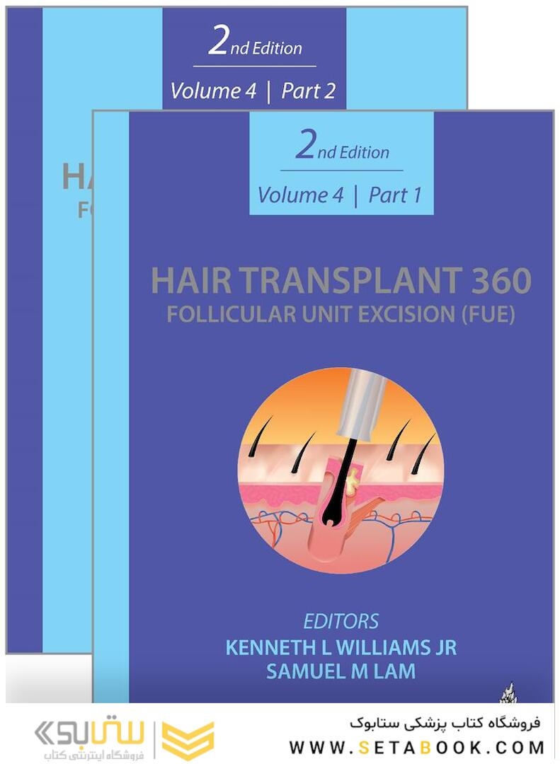 Hair Transplant 360: Follicular Unit Excision 2020