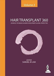 عکس Hair Transplant 360 1st Edition2014