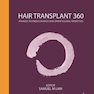 Hair Transplant 360 1st Edition2014