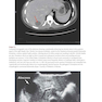 Red Book Atlas of Pediatric Infectious Diseases