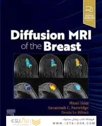 DIFFUSION MRI OF THE BREAST, E-Book